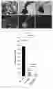 Fig. 08 - Membrane-type metalloprotease inhibitory protein and pharmaceutical and pharmaceutical composition containing same, and respective uses thereof