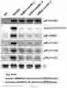 Fig. 09 - Insulin receptor aptamer and pharmaceutical composition for treating diabetes comprising the same