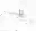 Fig. 02 - System and method for electrospinning superfine fiber bundling