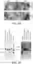 Fig. 03 - METHOD AND SYSTEM FOR IDENTIFYING COLON CANCER-SPECIFIC VESICLE-ASSOCIATED PROTEINS FROM TISSUE SAMPLE