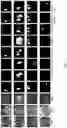 Fig. 08 - MULTISTREAM FUSION ENCODER FOR PROSTATE LESION SEGMENTATION AND CLASSIFICATION
