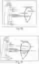 Fig. 16 - Methods and apparatuses for estimating bladder status