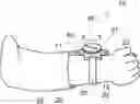 Fig. 01 - Banded spinning device and watch