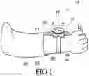 Fig. 02 - Banded spinning device and watch