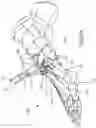 Fig. 07 - BONE SLIVER REMOVAL SYSTEM