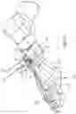 Fig. 09 - BONE SLIVER REMOVAL SYSTEM