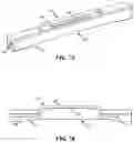 Fig. 07 - Devices and methods for forming a fistula
