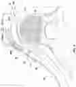 Fig. 06 - METHODS AND DEVICES FOR ENDOVASCULAR ABLATION OF A SPLANCHNIC NERVE