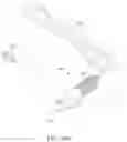 Fig. 45 - Systems, devices, and methods for forming an anastomosis