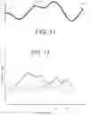 Fig. 09 - METHOD AND APPARATUS FOR PREPARING AND IMPLANTATION OF MEDICAL IMPLANTS