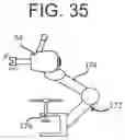 Fig. 22 - METHOD AND APPARATUS FOR PREPARING AND IMPLANTATION OF MEDICAL IMPLANTS
