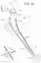 Fig. 28 - METHOD AND APPARATUS FOR PREPARING AND IMPLANTATION OF MEDICAL IMPLANTS