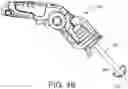 Fig. 32 - METHOD AND APPARATUS FOR PREPARING AND IMPLANTATION OF MEDICAL IMPLANTS