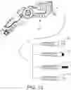 Fig. 35 - METHOD AND APPARATUS FOR PREPARING AND IMPLANTATION OF MEDICAL IMPLANTS
