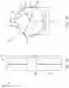 Fig. 02 - VALVED CONDUIT PROSTHESES