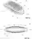 Fig. 02 - Implants and Instruments with Flexible Features