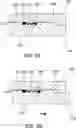 Fig. 06 - CONFIGURABLE TIME-DELAYED ORAL MANDIBLE POSITIONING DEVICE