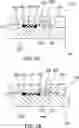 Fig. 07 - CONFIGURABLE TIME-DELAYED ORAL MANDIBLE POSITIONING DEVICE