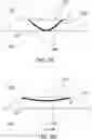 Fig. 08 - CONFIGURABLE TIME-DELAYED ORAL MANDIBLE POSITIONING DEVICE