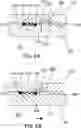 Fig. 09 - CONFIGURABLE TIME-DELAYED ORAL MANDIBLE POSITIONING DEVICE