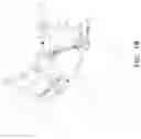 Fig. 03 - MICROSURGICAL ROBOTIC SYSTEM WITH REMOTE CENTER OF MOTION