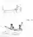 Fig. 12 - MICROSURGICAL ROBOTIC SYSTEM WITH REMOTE CENTER OF MOTION