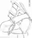 Fig. 22 - Systems and methods for head up cardiopulmonary resuscitation