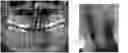 Fig. 01 - A PREPARATION FOR PERIODONTAL TISSUE AND A KIT COMPRISING THE SAME