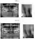 Fig. 02 - A PREPARATION FOR PERIODONTAL TISSUE AND A KIT COMPRISING THE SAME