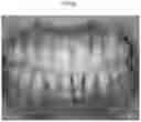 Fig. 06 - A PREPARATION FOR PERIODONTAL TISSUE AND A KIT COMPRISING THE SAME