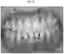 Fig. 07 - A PREPARATION FOR PERIODONTAL TISSUE AND A KIT COMPRISING THE SAME