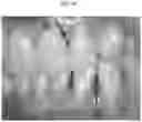 Fig. 08 - A PREPARATION FOR PERIODONTAL TISSUE AND A KIT COMPRISING THE SAME