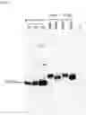 Fig. 02 - Engineering, production and characterization of plant produced Nucleocapsid and Spike structural proteins of SARS CoV 2 as vaccine candidates against COVID19