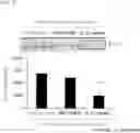 Fig. 06 - Double Stranded RNA Specifically Inhibiting Expression of IL-23 and Pharmaceutical Composition Comprising Same