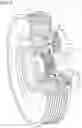 Fig. 03 - Filtering pulley