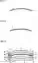 Fig. 02 - FUNCTIONAL POLARIZING ELEMENT FOR INSERT MOLDING AND FUNCTIONAL POLARIZING LENS