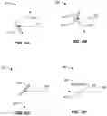 Fig. 07 - Method and system for multi-view episcopic selective plane illumination microscope
