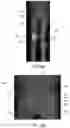 Fig. 09 - System and Method for Obtaining Accurate Measurements and Quantification of X-Ray Image from Estimation of Key Anatomical Locations