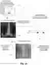 Fig. 02 - Image data set alignment for an AR headset using anatomic structures and data fitting