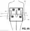 Fig. 06 - Image data set alignment for an AR headset using anatomic structures and data fitting