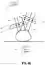 Fig. 07 - Image data set alignment for an AR headset using anatomic structures and data fitting