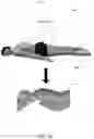 Fig. 02 - Systems and methods for designing and manufacturing custom immobilization molds for use in medical procedures
