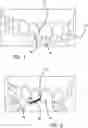 Fig. 02 - Kit and Method for Home Use for Interproximal Reduction (IPR) Stripping of Teeth for Braces or Aligners