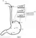 Fig. 06 - INFORMATION PROCESSING METHOD, ELECTRONIC DEVICE, AND COMPUTER STORAGE MEDIUM