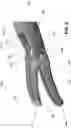 Fig. 10 - JAW MEMBER, END EFFECTOR ASSEMBLY, AND METHOD OF MANUFACTURING A JAW MEMBER OF AN ELECTROSURGICAL INSTRUMENT