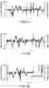 Fig. 09 - DISEASE-CONDITION ASSESSMENT DEVICE, DISEASE-CONDITION ASSESSMENT METHOD, PROGRAM FOR DISEASE-CONDITION ASSESSMENT DEVICE, AND DISEASE-CONDITION ASSESSMENT SYSTEM