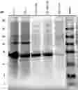 Fig. 01 - REDUCTASE ENZYMES AND PROCESSES FOR MAKING AND USING REDUCTASE ENZYMES
