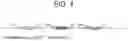 Fig. 02 - Method for Preparing Plasmid Containing Type I Polyketide Synthase Gene