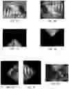 Fig. 07 - UNIAXIAL OPTICAL MULTI-MEASUREMENT IMAGING SYSTEM