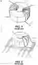 Fig. 02 - SURFACE-MOUNT-ASSEMBLY Z-SHAPED PIN